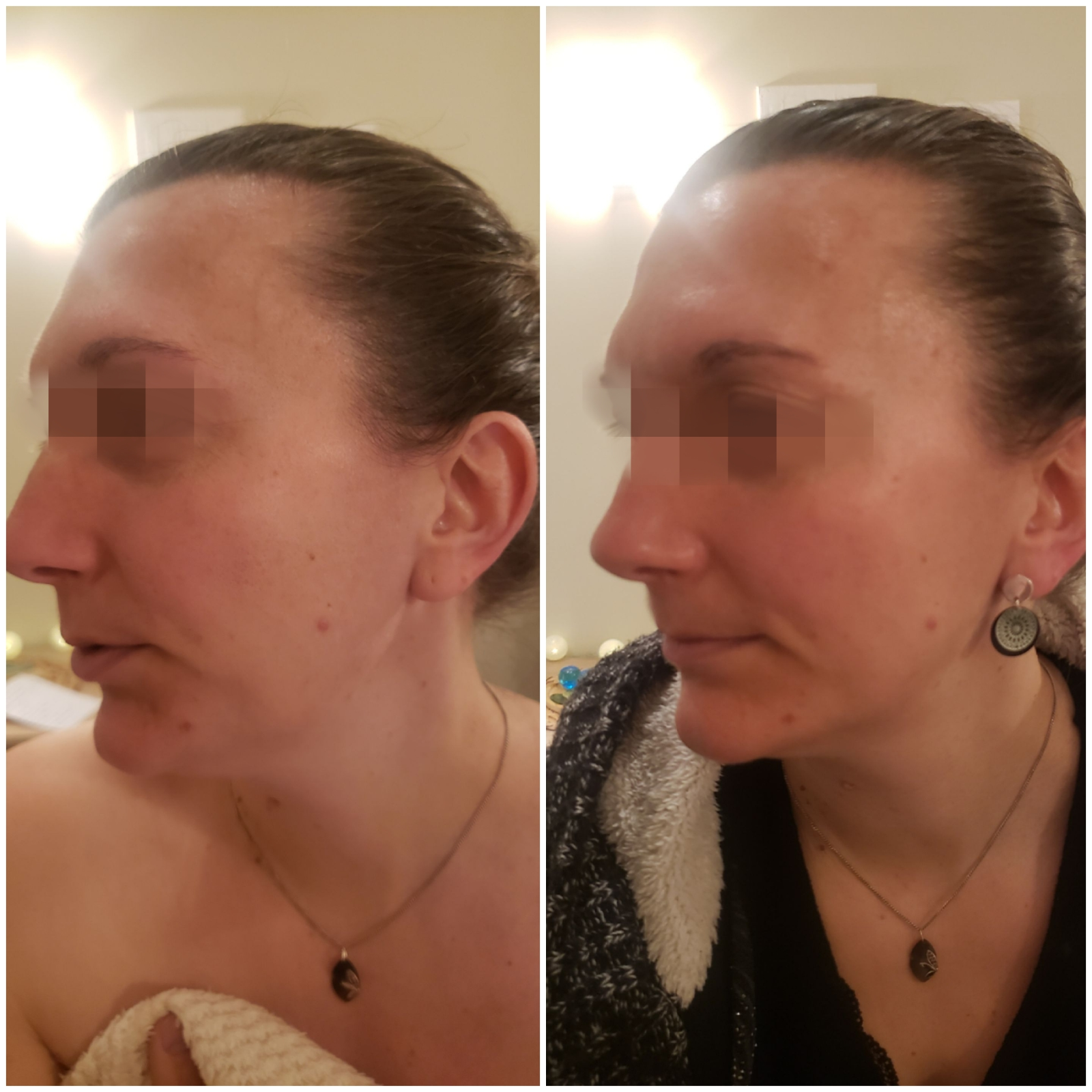 Stretching facial