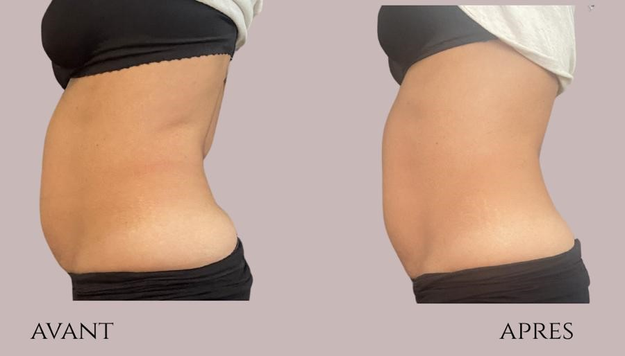 Belly Sculpt